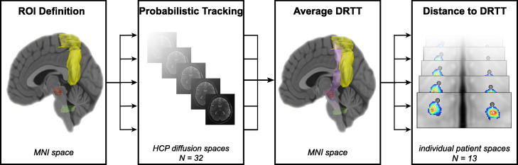 PSA and VIM DBS efficiency in essential tremor depends on distance to ...