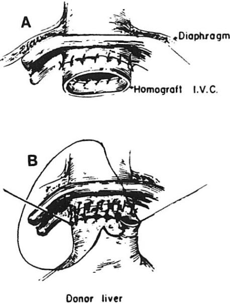 Fig 12