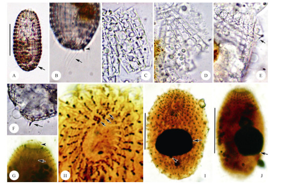 Microphotographs of living <i>Coleps amphacanthus</i> and after protargol impregnation<br> A: Lateral view of a typical individual, arrow indicates contractile vacuole. B: Lateral view of posterior section of the body, arrow marks caudal cilia, arrowhead denotes posterior spine. C: Posterior main plates. D: Anterior main plates. E: Lateral view of the anterior section of the cell, showing anterior spine (arrow) . F: Lateral view of the posterior end of the body, arrow indicates posterior spine. G: Lateral view of anterior portion, showing internal (arrowhead) and external (arrow) oral basket. H: Detailed infraciliature of the apical end, arrows denote three adoral organelles. I: Infraciliature of a pressed specimen showing ciliary pattern, arrow denotes macronucleus, arrowhead indicates micronucleus. J: Lateral view of a specimen on a permanent slide, arrow denotes macronucleus. Scale bars=50 μm.