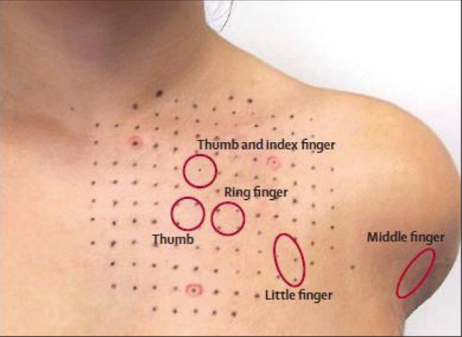 Figure 14)