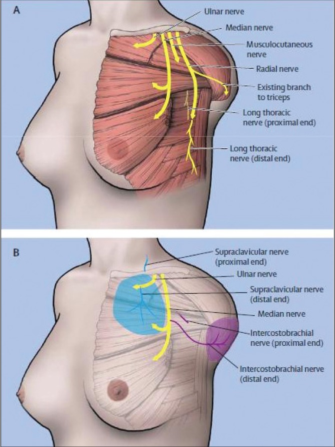 Figure 13)