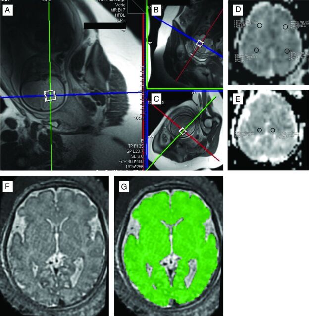 Fig 1.