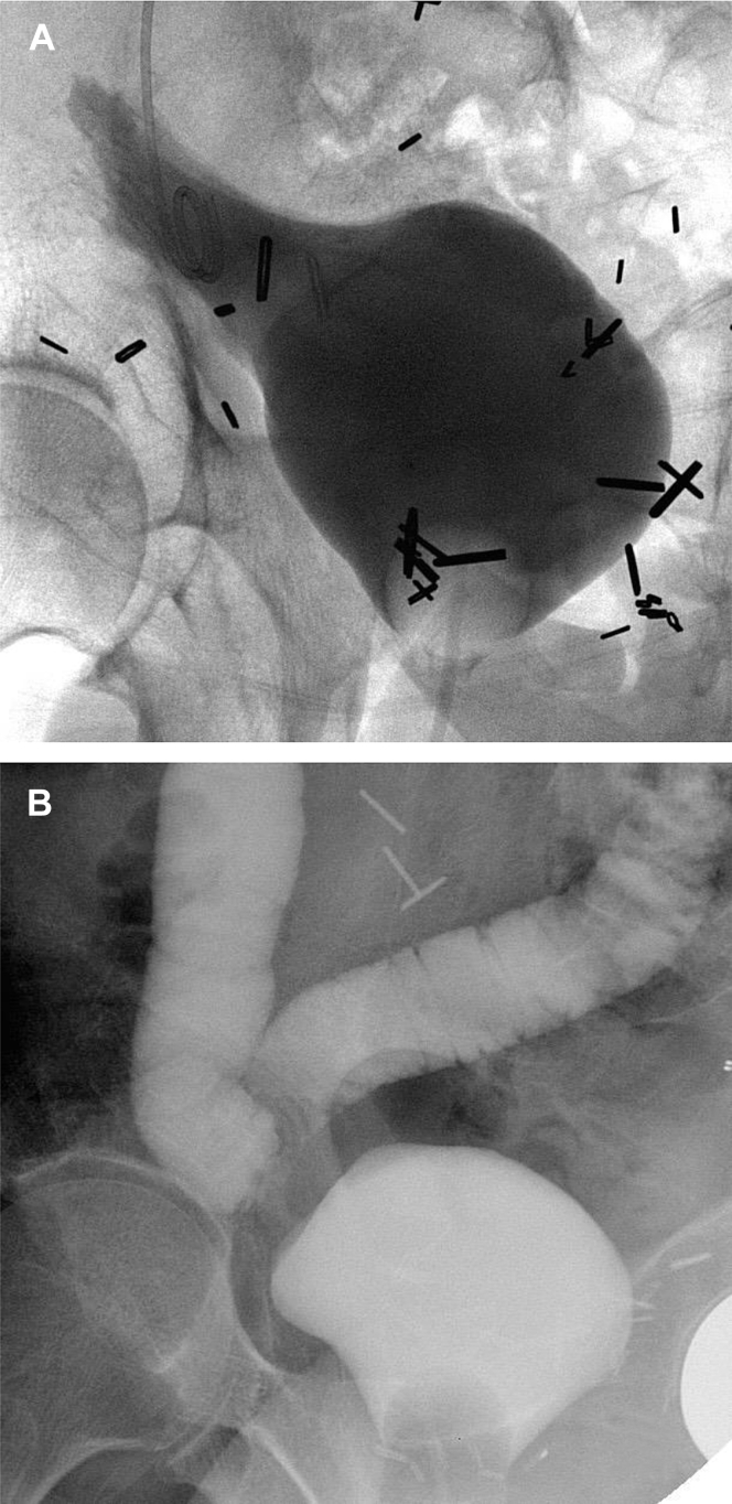 Figure 2