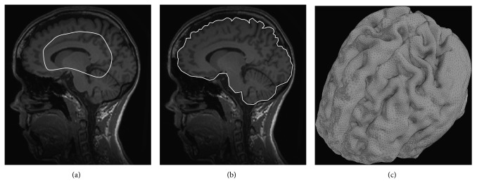 Figure 14