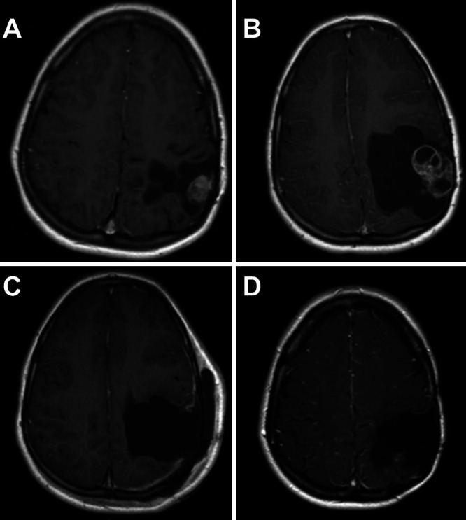 FIG. 1