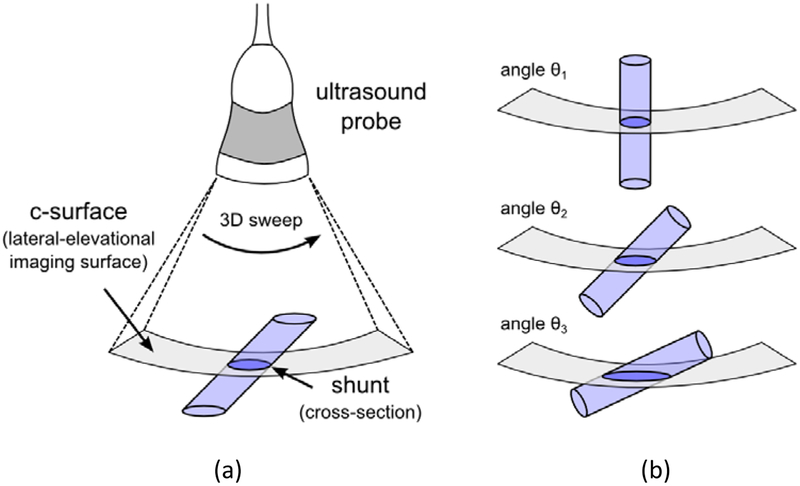 Figure 1: