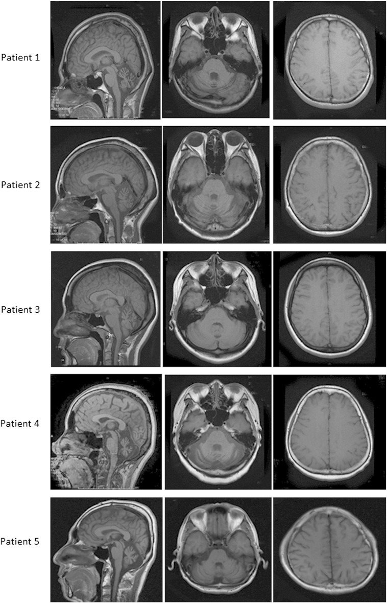 Fig. 1