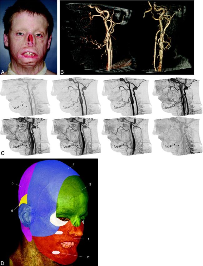 Fig 3.