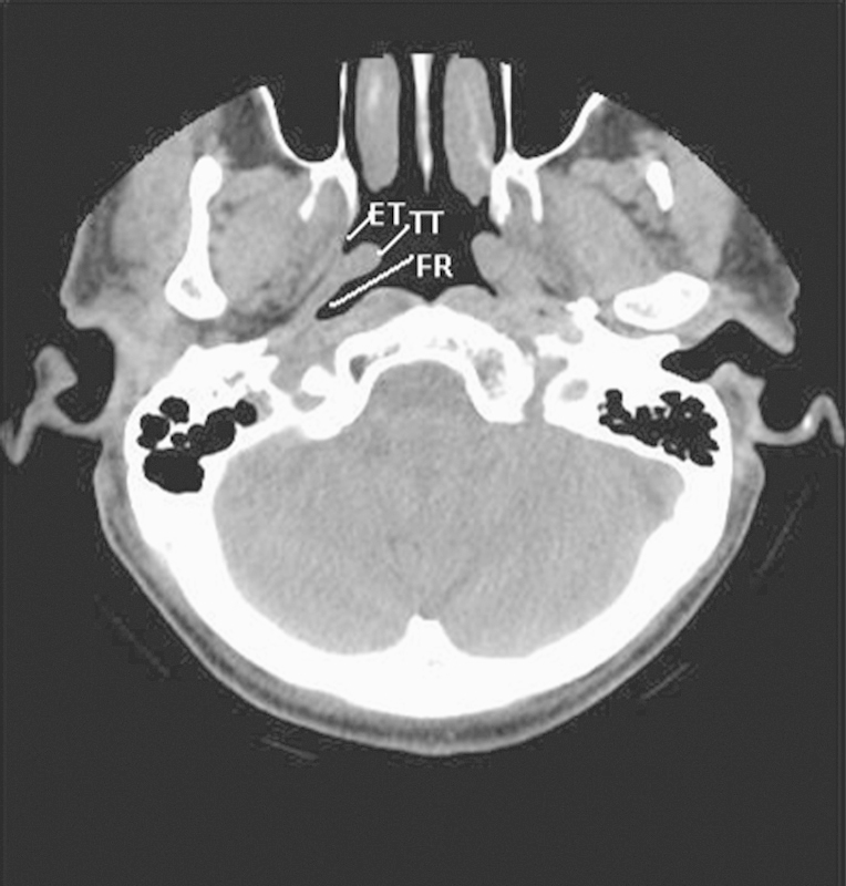 Fig. 8