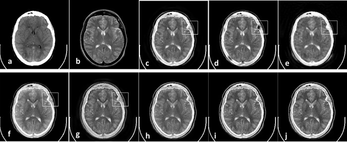 Fig 11
