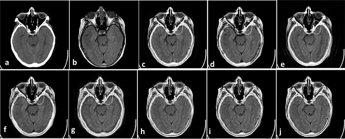Fig 10