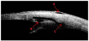 Fig. (3)