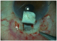 Fig. (2)