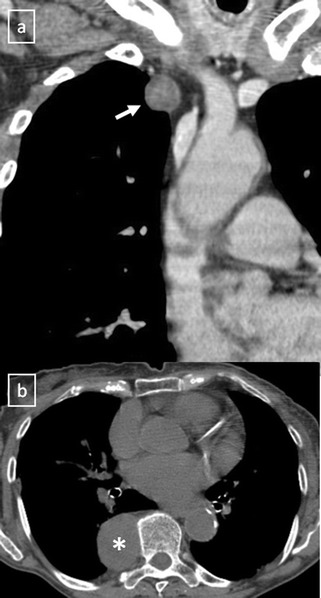 Fig. 29