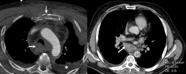 Fig. 34