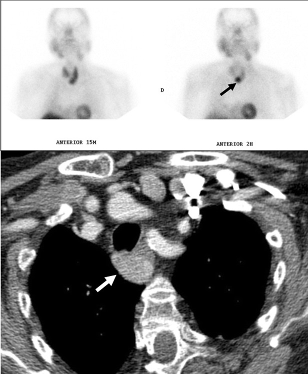 Fig. 32