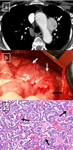 Fig. 31