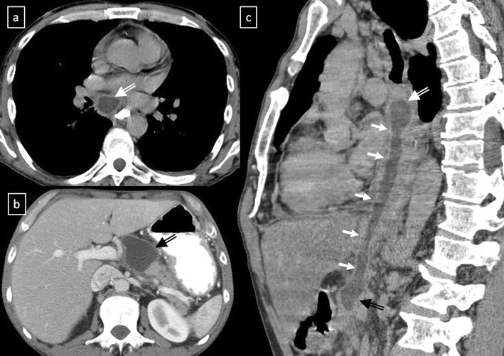 Fig. 13