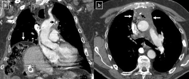 Fig. 33