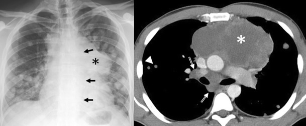 Fig. 28