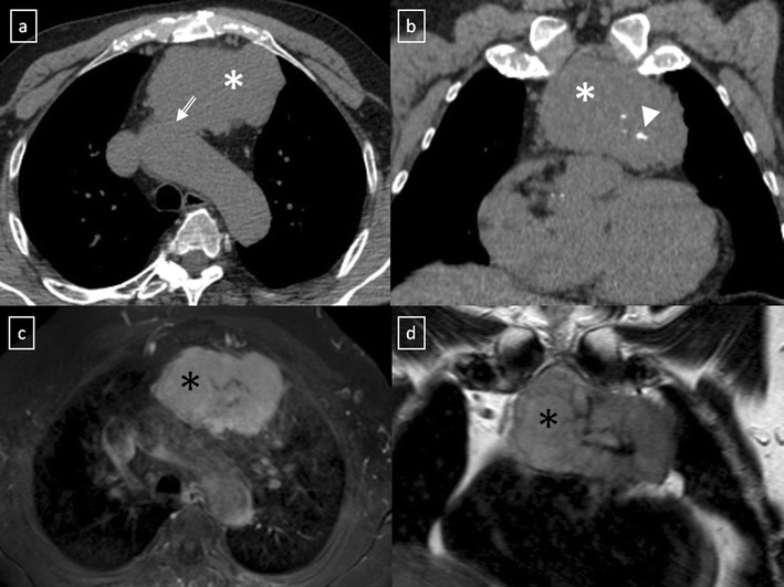 Fig. 21