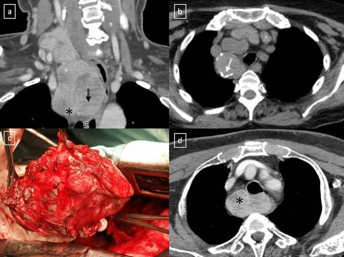 Fig. 14