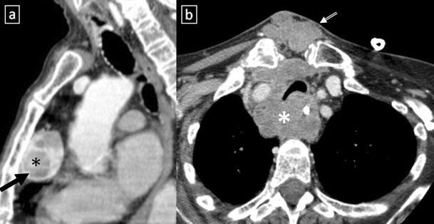 Fig. 15