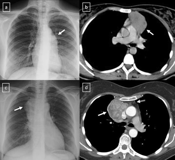 Fig. 18