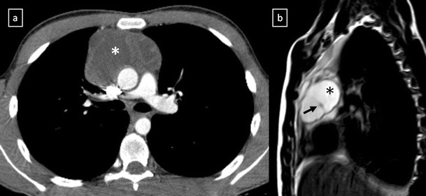 Fig. 11