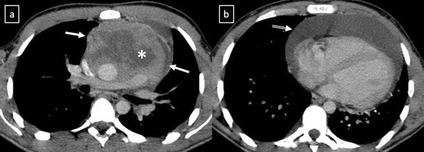 Fig. 25