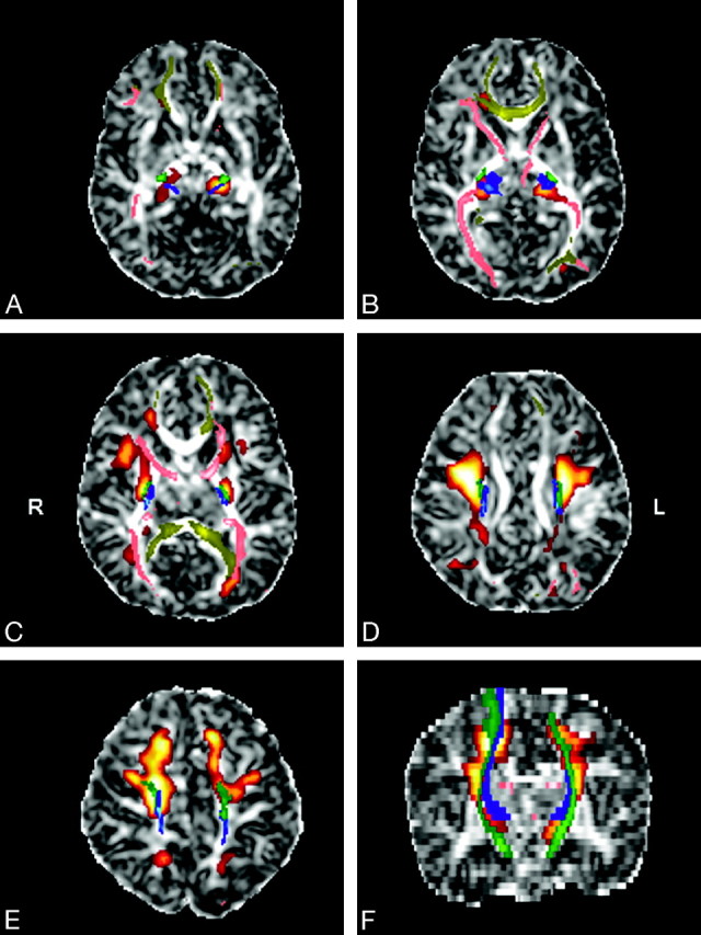 Fig 3.