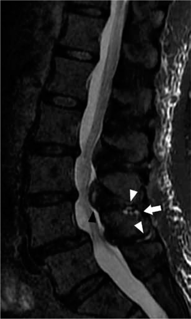 Figure 21