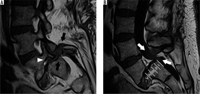 Figure 20