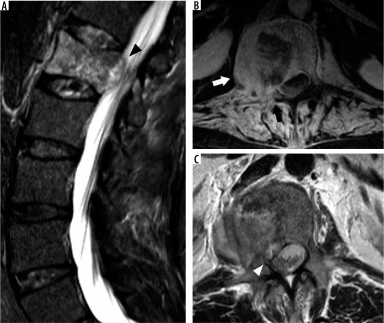 Figure 31