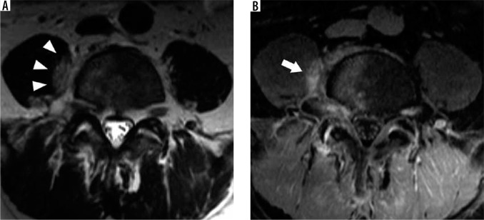 Figure 26