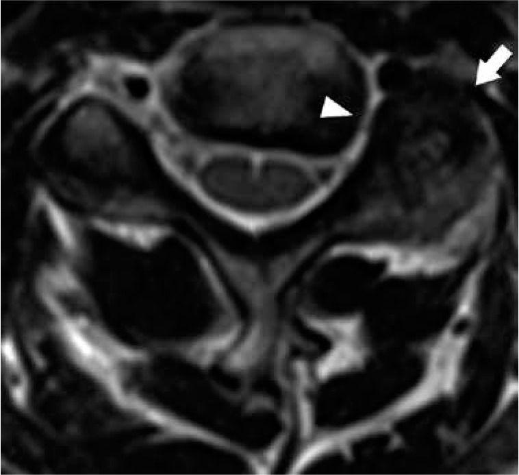 Figure 15