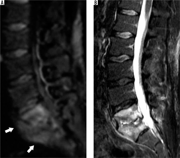 Figure 25