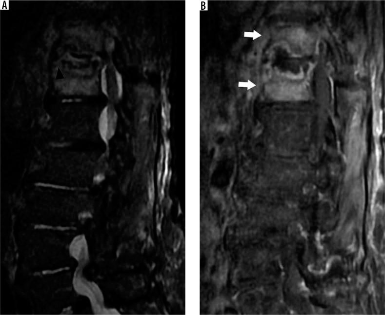 Figure 23