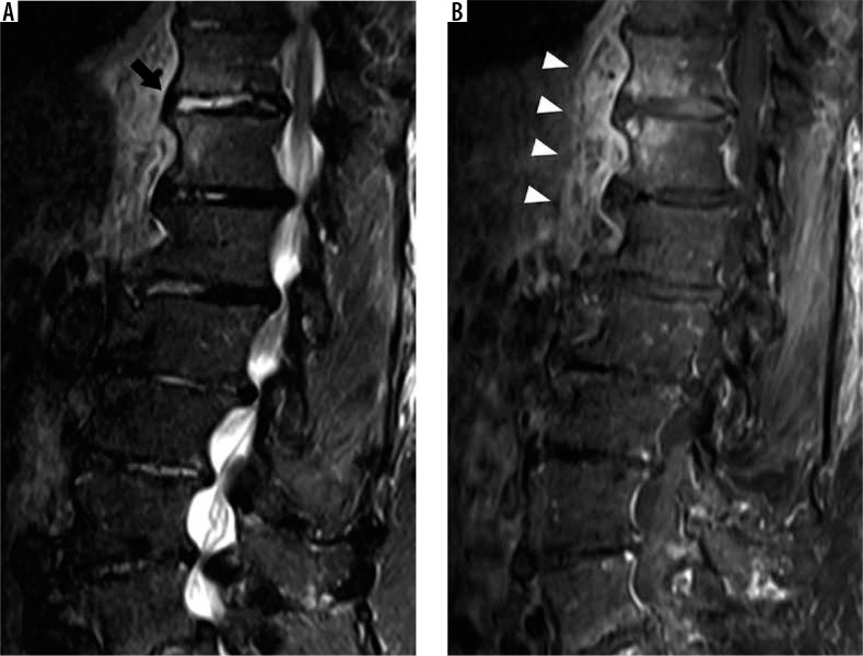 Figure 22