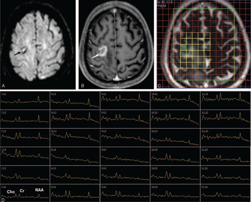 FIGURE 1