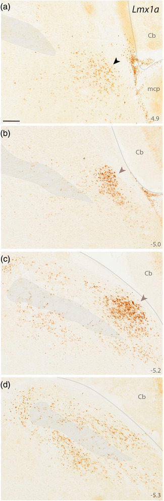 FIGURE 11