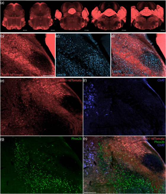 FIGURE 14