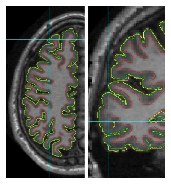 Figure 10