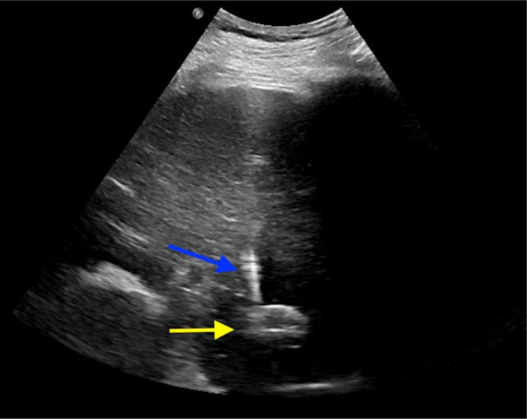 Fig 2 –