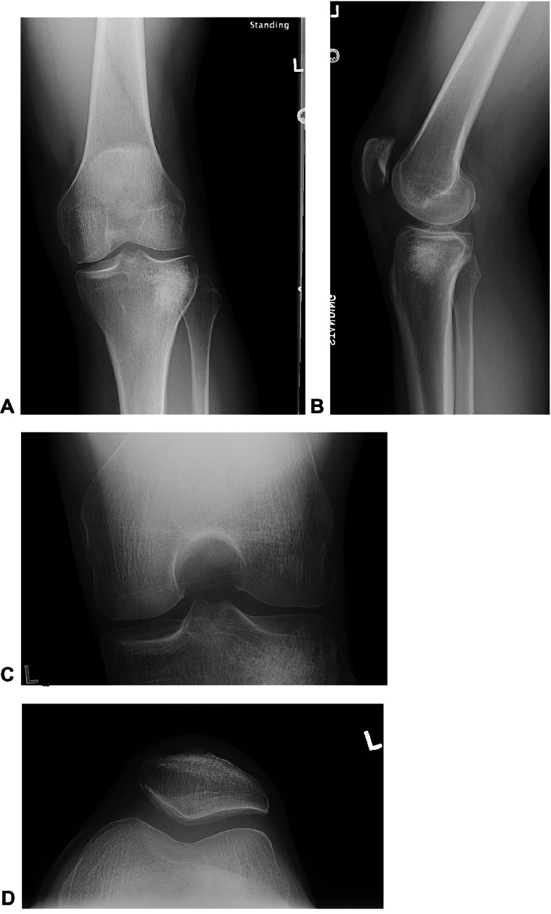 Fig 6