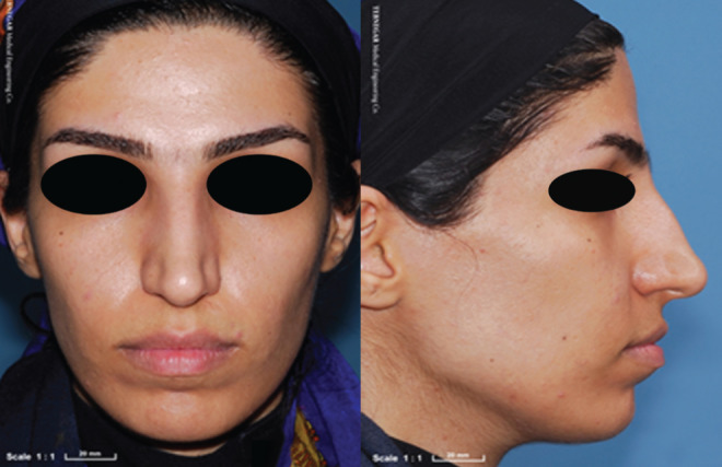Figure 13)