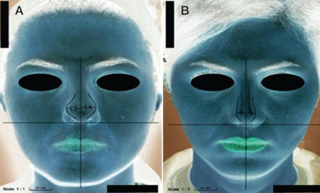 Figure 6)