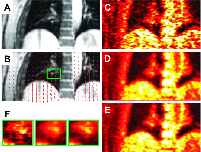 FIG. 12.