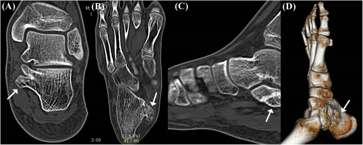 Fig. 2