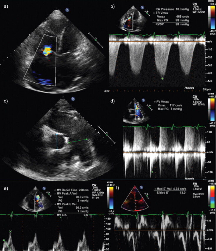 Figure 2.